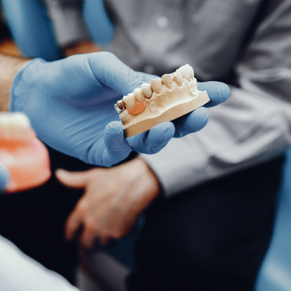 How do Dental Implants Work: All You Need to Know