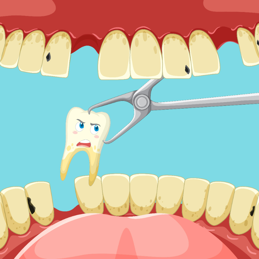 Can I Brush My Teeth After Tooth Extraction? A Comprehensive Guide - Oclean FAQs